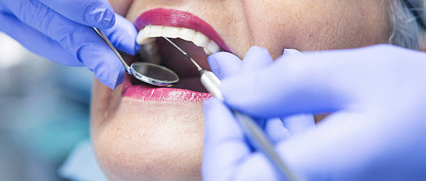 Best Lost Filling or Crown Replacement in Youngsville, LA